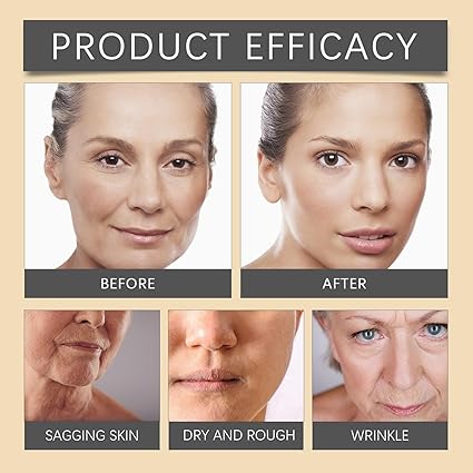 OUHOE Bee Venom Botox Wrinkle Cream